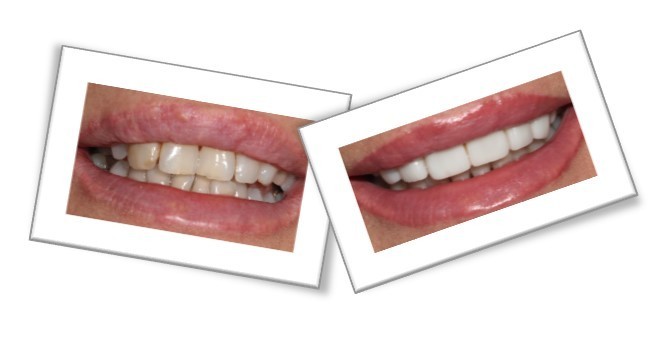 Cosmetic Dentistry