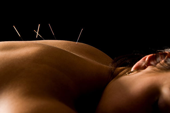 Physiotherapy Melton Mowbray, Acupuncture Sports Injury, Back Pain Injury Neck