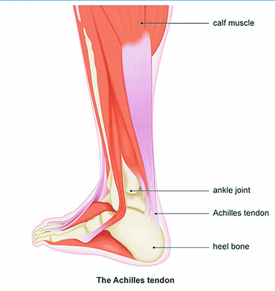 Achilles Pain