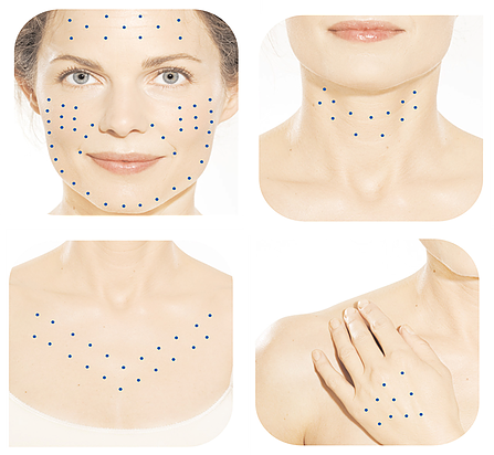 Botox Sheffield, Fillers Sheffield, Nurse Louise Beer