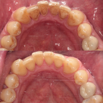 Dental Hygienist Barnet
