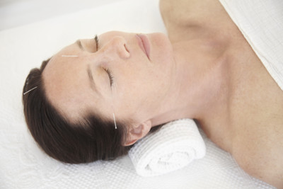Natural Alternative to Botox Facial Acupuncture London , Cosmetic Acupuncture Chelsea, Facial Rejuvenation Acupuncture Bromley