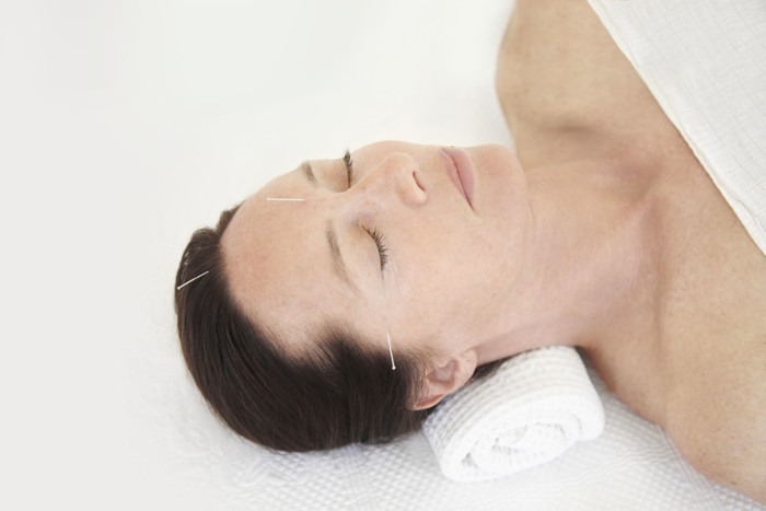 Natural Alternative to Botox Facial Acupuncture London , Cosmetic Acupuncture Chelsea, Facial Rejuvenation Acupuncture Bromley