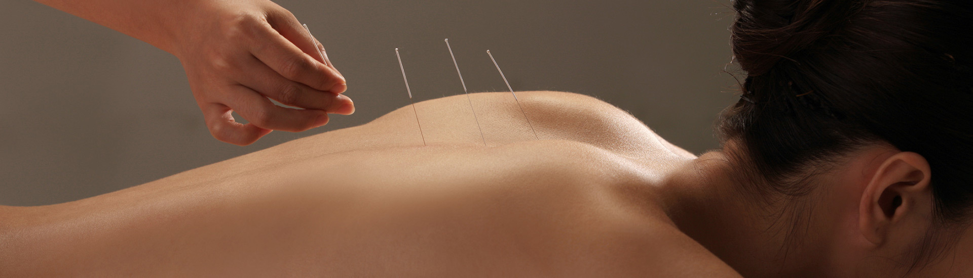 Back Pain Physiotherapy Watford