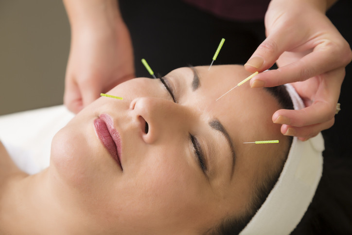 Cosmetic Facial Acupuncture