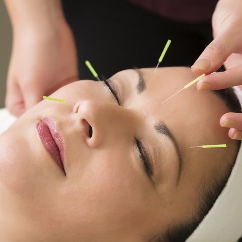 Cosmetic Facial Acupuncture