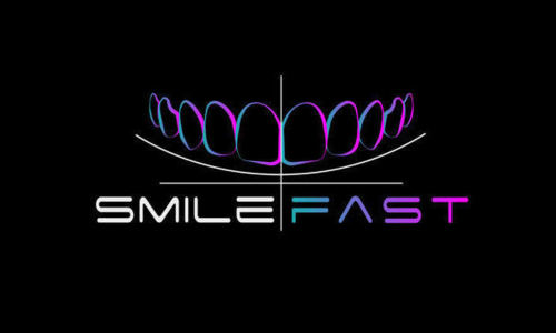 Composite bonding, WHite fillings, bonding, Smilefast